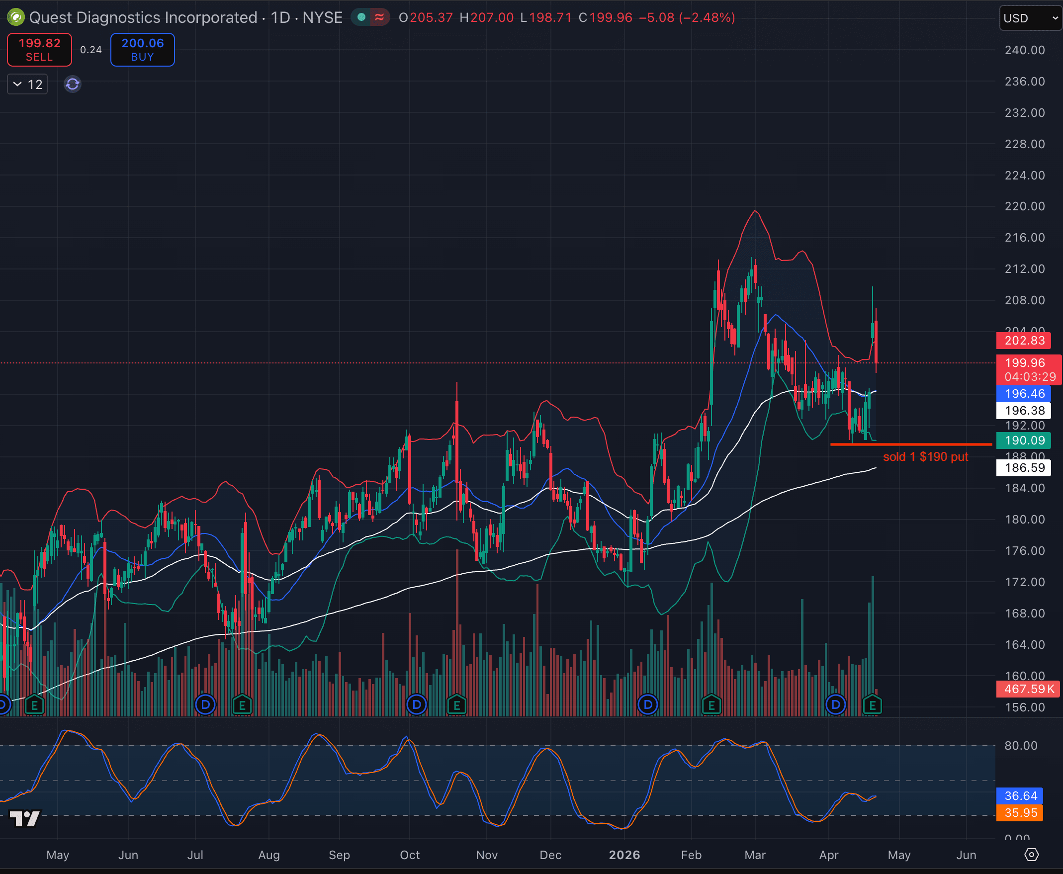 DGX short put